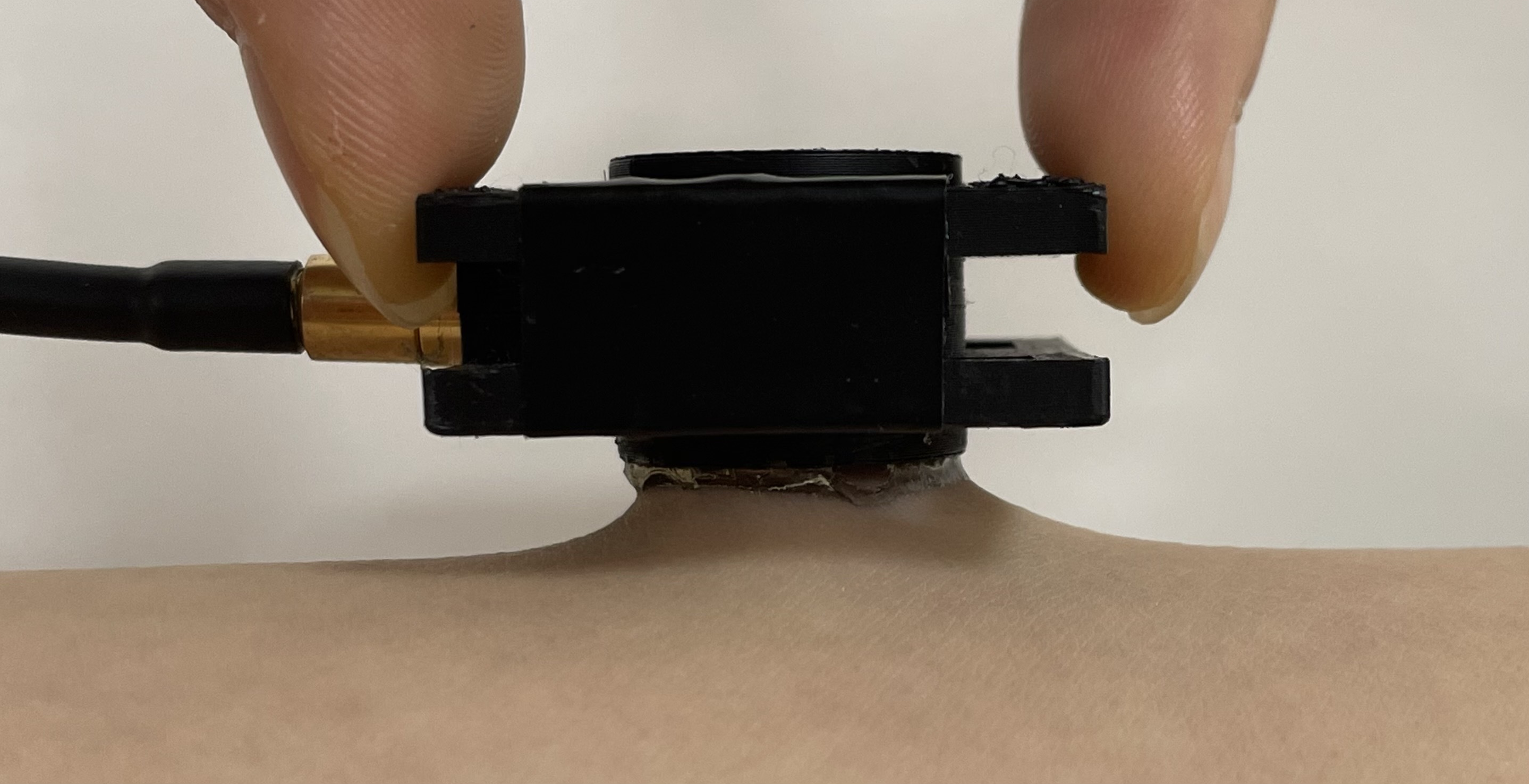 The transducer housing lifted from the forearm; the couplant stays bonded and tents the skin upward with it.